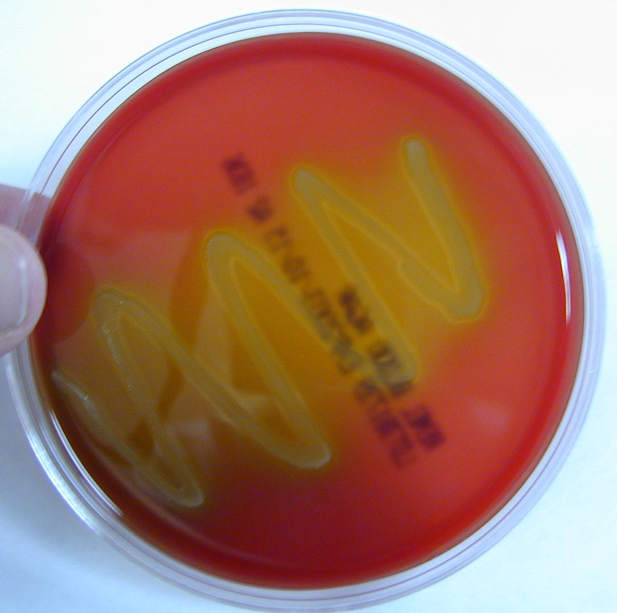 Selective and Diff Media List